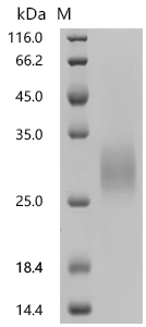 RANKL/TNFSF11/CD254 Protein, Human, Recombinant (His)