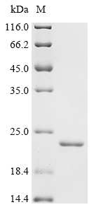 BAZ2B Protein, Human, Recombinant (His)