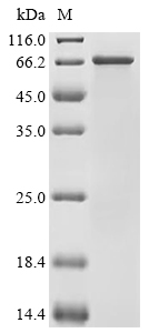 PAIP1 Protein, Human, Recombinant (His & Myc)