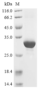 FOXP3 Protein, Human, Recombinant (His)