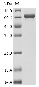 AP1B1 Protein, Human, Recombinant (His & Myc)