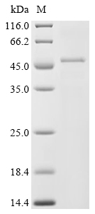 Rotavirus A (strain RVA/Human/United States/Wa/1974/G1P1A[8]) VP6 Protein (His)