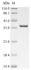 HlgB Protein, S. aureus, Recombinant (E. coli, His)