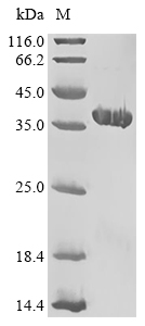 Interferon alpha 14/IFNA14 Protein, Human, Recombinant (His & SUMO)
