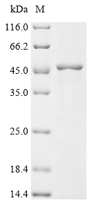 FSHR Protein, Human, Recombinant (E. coli, His)