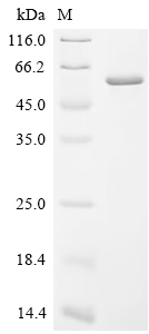 RIG-I Protein, Human, Recombinant (His)