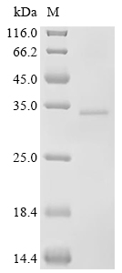 TMEM158 Protein, Human, Recombinant (His)