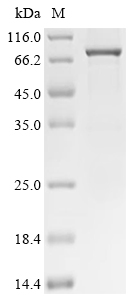 HDAC1 Protein, Human, Recombinant (His & SUMO)