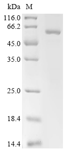 CYP2A6 Protein, Human, Recombinant (His & Myc)