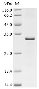 LOX Protein, Human, Recombinant (His)