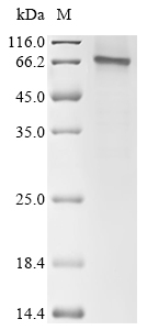 PPAR alpha/PPARA Protein, Human, Recombinant (aa 1-468, His)