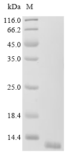 CT83 Protein, Human, Recombinant (E. coli, His)
