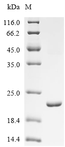 yqgB Protein, E. coli, Recombinant (His & KSI)