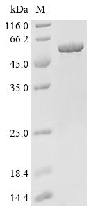 FDXR Protein, Human, Recombinant (His & SUMO)