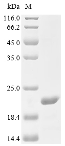C5AR1 Protein, Human, Recombinant (His & KSI)
