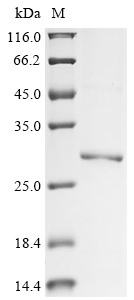 RAB10 Protein, Human, Recombinant (His)