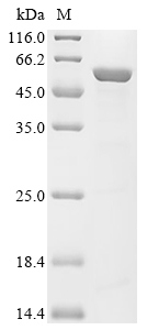 ATP6V1B2 Protein, Human, Recombinant (His & Myc)