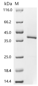 PBP1b Protein, E. coli, Recombinant (His)