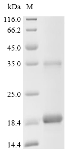 SLIT3 Protein, Human, Recombinant (His)