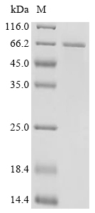 HTRA1 Protein, Human, Recombinant (His & SUMO)