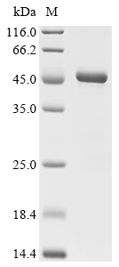 UCP1 Protein, Human, Recombinant (His & SUMO)