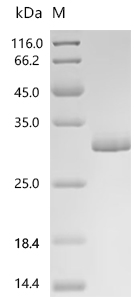CPS1 Protein, Mouse, Recombinant (His)