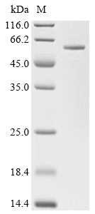 AKR1B10 Protein, Human, Recombinant (GST)
