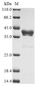 COL11A1 Protein, Human, Recombinant (GST)