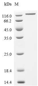 ENPP3 Protein, Cynomolgus, Recombinant (His)