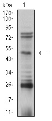 Anti-TFAP2B Monoclonal Antibody (1Q788)