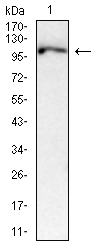 Anti-PRDM1 Monoclonal Antibody (2Q922)
