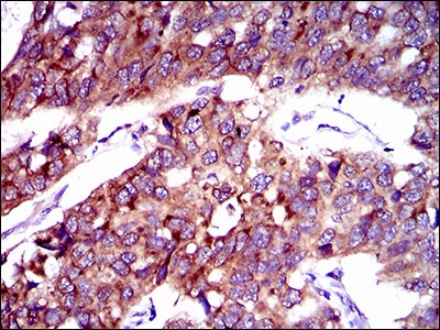 Anti-SLC27A2 Monoclonal Antibody (5A485)