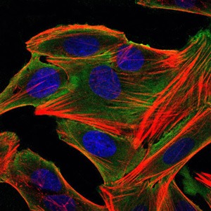 Anti-RSK2 Monoclonal Antibody (5C500)