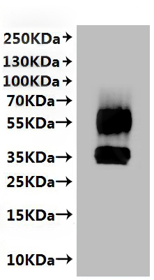 CD20 Protein-VLP, Rat, Recombinant (His)