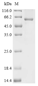 SKP2 Protein, Human, Recombinant (His & SUMO)