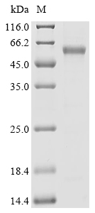 AURKA Protein, Human, Recombinant (His)