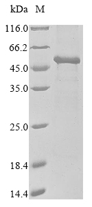 PDHA1 Protein, Human, Recombinant (His & Myc)