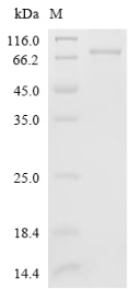 METTL3 Protein, Human, Recombinant (His)