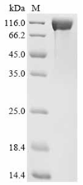 CEACAM5 Protein, Human, Recombinant (E398K, His)