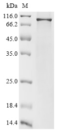 BCL6 Protein, Human, Recombinant (His)