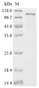 RBM14 Protein, Human, Recombinant (His & SUMO)