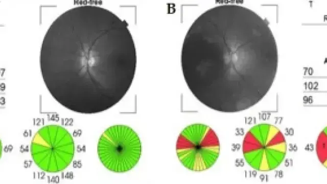 [TargetMol Star Molecule] - Idebenone: A Key Molecule Connecting Mitochondrial Energy and Antioxidant Protection